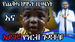 የጨቅላ ህፃናት ቢጫነት ካልታከመ የሚያመጣቸው የነርቭ ጉዳቶች  Neonatal Jaundice complications  DrFasil  ብሩህkids [upl. by Shepperd]