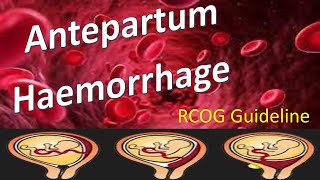 Antepartum Haemorrhage  RCOG Guideline [upl. by Mikol949]