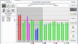 Virtual Electrodermal Screening TCM [upl. by Gnuy875]