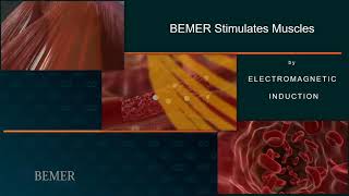 BEMER  A Look Inside our Microvascular System [upl. by Treblih]