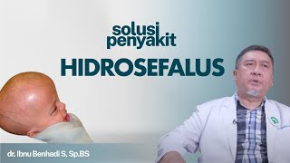 Hidrosefalus Gejala Penyebab dan Cara Mengatasi  Kata Dokter167 [upl. by Atiuqahc]