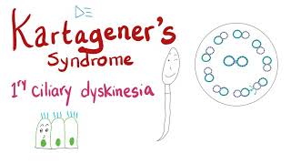 Kartageners Syndrome Immotile Cilia Syndrome or Primary Ciliary Dyskinesia  Pulmonology [upl. by Drobman]