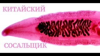 Клонорх Китайская Двуустка Clonorchis sinensis Клонорхоз Строение Клиника Диагностика Профилактика [upl. by Freeland]