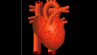 Attaque cardiaque infarctus du myocarde [upl. by Letty]