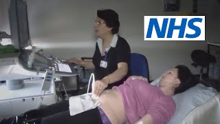 What happens at a scan and what will they tell me  NHS [upl. by Dnamra]