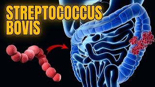 All About Streptococcus bovis Causes Pathogenesis Symptoms amp Treatment  Microbiology 101 Lec [upl. by Sudbury]