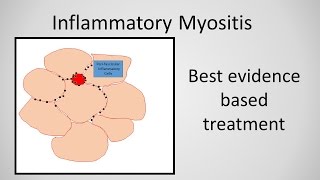 Myositis Inflammatory Myopathy Treatment [upl. by Fidel368]