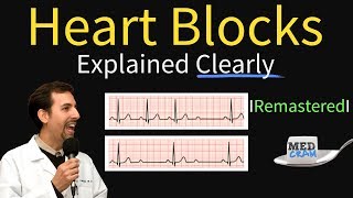 Heart Blocks Explained  First Second Third Degree and Bundle Branch on ECG [upl. by Evetta]