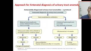 What is the best Approach for Antenatal diagnosis of urinary tract anomaly  Prophylaxis antibiotics [upl. by Quirita212]