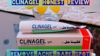 CLINAGEL gel Review Remove pimples acne Acne scarsdark spot [upl. by Brenza]