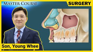 Master Course Season2  SURGERY Anatomy amp Physiology of Maxillary Sinus [upl. by Ennaehr938]