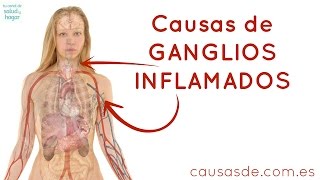 Causas de ganglios inflamados [upl. by Lustig]