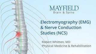 Electromyography EMG amp Nerve conduction studies NCS [upl. by Ahseikram586]