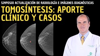 Actualización en radiología Tomosíntesis Aporte clínico y casos [upl. by Alroi]