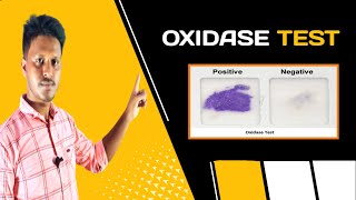 Oxidase Test AZ  in Bangla video [upl. by Enitsenre]