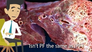 Is Pulmonary Fibrosis the same as Idiopathic Pulmonary Fibrosis [upl. by Aneerbas]