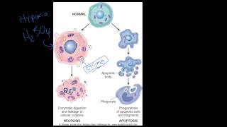 4  Introduction to Pathology  Necrosis vs Apoptosis [upl. by Mabel]