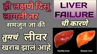 Liver failure symptoms in marathi । लीवर खराब होण्याची कारणे आणि लक्षणे । [upl. by Romito]