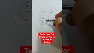 Technique For Giving Buttock Gluteal IM Injection gluteal injection drsaichandra [upl. by Slosberg621]