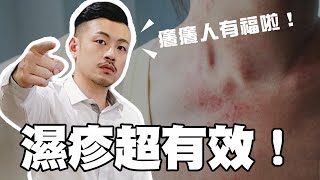 濕疹、汗皰疹好不了！？簡單幾招還你美麗好皮膚！癢癢必學！【77老大】 [upl. by Dhu]