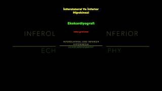 Ekokardiyografi  İnferolateral Ve İnferior Hipokinezi [upl. by Zachery]