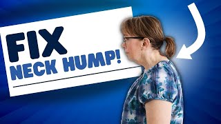 How to Fix Your Neck Hump Fast [upl. by Ydnir]