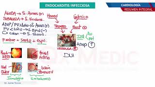 que es la endocarditis bacteriana [upl. by Decamp9]