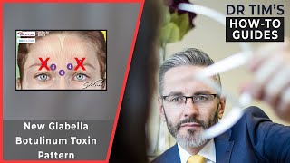 New Glabella Botulinum Toxin Pattern [upl. by Lovering]