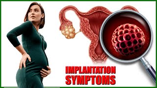 Implantation Symptoms – Top 7 Early Signs and Symptoms of Implantation [upl. by Puduns]