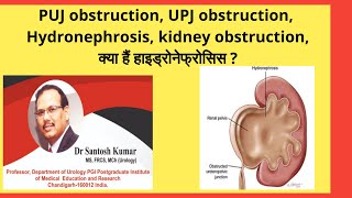 PUJ obstruction UPJ obstruction क्या हैं  Hydronephrosis के कारण  DrProfSantosh Kumar PGI [upl. by Maze]