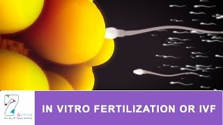 IN VITRO FERTILIZATION OR IVF [upl. by Papert]