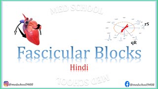 Fascicular Blocks Hindi [upl. by Naiviv]