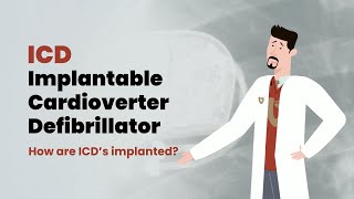 How Does an ICD Work Your Heart Rhythm Safety Net Explained [upl. by Iramo]