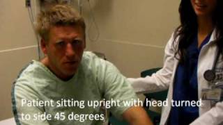 Hallpike Test and Epley Maneuver [upl. by Aserehc]