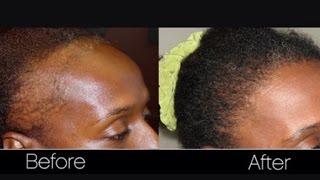 BLACK JAMACIAN CASTOR OIL FOR HAIR GROWTH NATURAL HAIR GROWTH TIPS [upl. by Sabec]