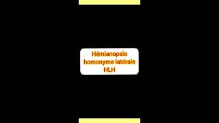 Hémianopsie latéral homonyme [upl. by Glennis905]