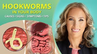 Hookworms  Causes Signs Symptoms amp Tips parasites  Dr J9 Live [upl. by Inail]