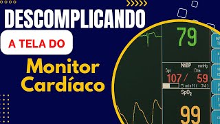 Interpretando a Tela do Monitor Cardíacoenfermagemnasctreinamentosenfermagem [upl. by Aierbma]