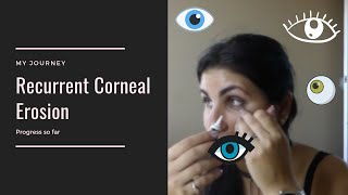 My Journey With Recurrent Corneal Erosion [upl. by Kliment]