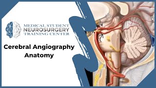 Cerebral Angiography Anatomy [upl. by Emelia]