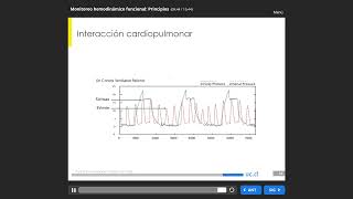 004 Principios de Monitoreo Hemodinámico Funcional [upl. by Domel]