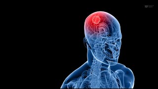 Unlocking Glioblastoma Treatment anticancer drug conjugate kills glioblastoma cells [upl. by Ssilb]