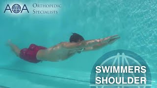 AOA Orthopedic Specialists  Swimmers Shoulder [upl. by Akcemat]