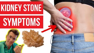 What symptoms do KIDNEY STONES cause Doctor explainsPLUS how kidney stones are diagnosed amp more [upl. by Nameloc]