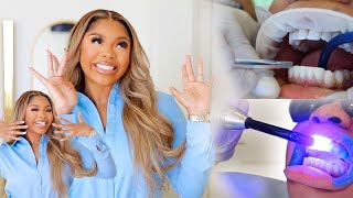 VLOG I GOT MY TEETH DONE IN TURKEY BEST VENEERS EVER w Prime Dental [upl. by Trinette]