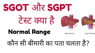 SGOT Blood Test  SGPT Blood Test  ALT  AST  SGOT amp SGPT Test Normal RangeMLTLabManual20 [upl. by Nueovas]