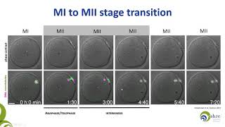 The importance of being mature Oocyte maturity assessment in clinical practice [upl. by Mcmullan198]