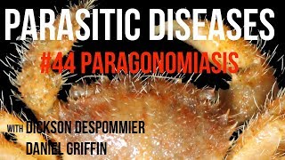 Parasitic Diseases Lectures 44 Paragonomiasis [upl. by Smart128]