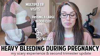 BLEEDING IN PREGNANCY  FIRST amp SECOND TRIMESTER BLEEDING  SUBCHORIONIC HEMATOMA PLACENTA PREVIA [upl. by Oicnanev432]