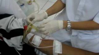 HEMODIALYSIS Procedure [upl. by Basia]